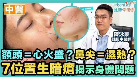 額頭中間生暗瘡|【暗瘡中醫處理】額頭＝心火盛？鼻尖＝濕熱？7大位。